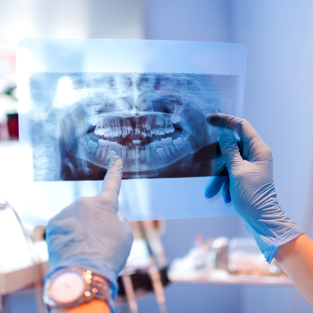 A dental professional in a blue gown and white gloves is holding up an X-ray of a human mouth, with the teeth clearly visible.